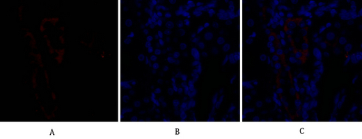 IF - Bad Polyclonal Antibody AP68618